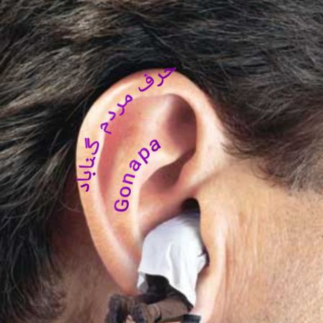 Channel Photo