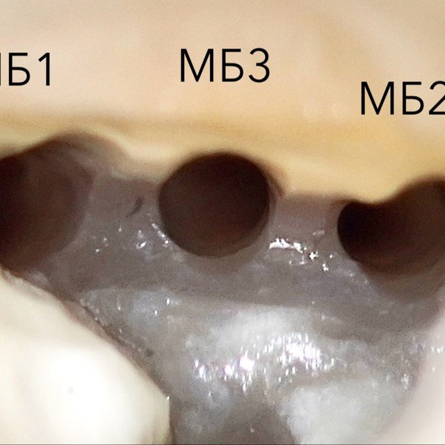 Channel Photo