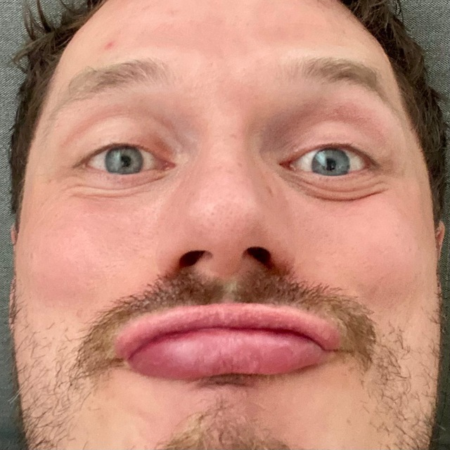 Channel Photo