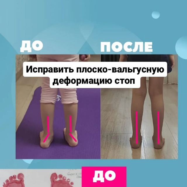 Channel Photo