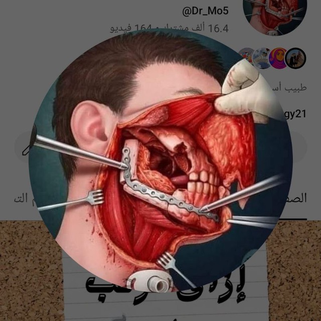 Channel Photo