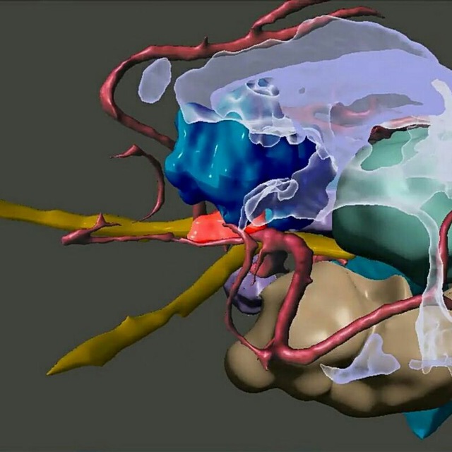 Channel Photo